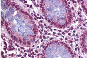 Human Colon: Formalin-Fixed, Paraffin-Embedded (FFPE) (KPNA4 抗体  (N-Term))