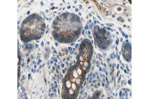 ABIN6266773 at 1/100 staining human colon tissue sections by IHC-P. (TNFSF13 抗体  (Internal Region))