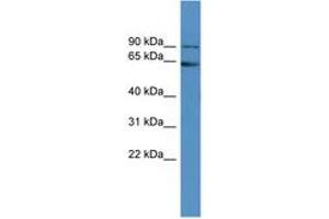 Image no. 1 for anti-Fragile X Mental Retardation 1 (FMR1) (AA 421-470) antibody (ABIN6746187) (FMR1 抗体  (AA 421-470))