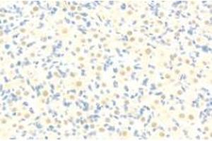 Immunohistochemistry (Paraffin-embedded Sections) (IHC (p)) image for anti-SIN3 homolog A, transcription regulator (SIN3A) antibody (ABIN7075609)