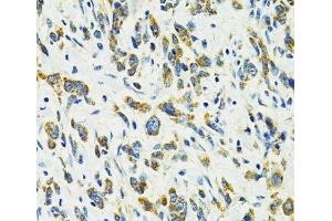 Immunohistochemistry (Paraffin-embedded Sections) (IHC (p)) image for anti-Solute Carrier Family 25 (Mitochondrial Carrier, Oxoglutarate Carrier), Member 11 (SLC25A11) antibody (ABIN7264223)
