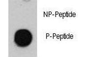 Dot Blot (DB) image for anti-Ataxia Telangiectasia Mutated (ATM) (pSer1981) antibody (ABIN3030033)