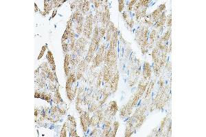 Immunohistochemistry of paraffin-embedded rat heart using VEGFB Rabbit pAb (ABIN7271298) at dilution of 1:150 (40x lens). (VEGFB 抗体  (AA 25-207))