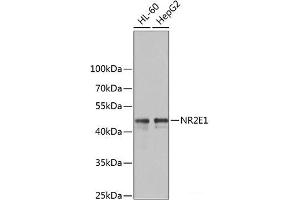 Western blot analysis of extracts of various cell lines using NR2E1 Polyclonal Antibody at dilution of 1:1000. (NR2E1 抗体)
