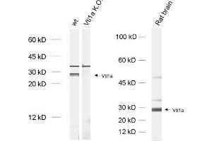 dilution: 1 : 1000, sample: brain homogenate from wildtype and Vti1a K. (VTI1A 抗体)