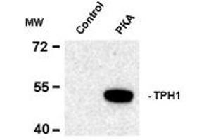 Image no. 2 for anti-Tryptophan Hydroxylase 1 (TPH1) (pSer58) antibody (ABIN227714) (Tryptophan Hydroxylase 1 抗体  (pSer58))