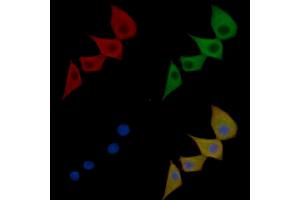 TrkA Mouse Monoclonal Antibody staining Hela cells by IF/ICC.