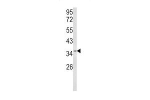 BRISC and BRCA1 A Complex Member 1 (BABAM1) (AA 116-143) 抗体