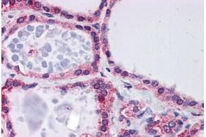 Human Thyroid: Formalin-Fixed, Paraffin-Embedded (FFPE) (Frataxin 抗体  (AA 105-154))
