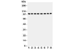 Western blot testing of CD10 antibody and Lane 1:  rat kidney (MME 抗体  (AA 52-750))