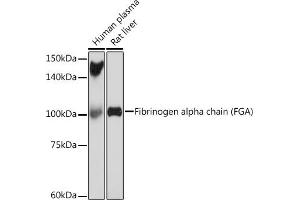 Western blot analysis of extracts of various cell lines, using Fibrinogen alpha chain (FGA) (FGA) Rabbit mAb (ABIN7267177) at 1:1000 dilution. (FGA 抗体)