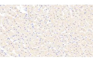 Immunohistochemistry (IHC) image for anti-Myosin Heavy Chain 1, Skeletal Muscle, Adult (MYH1) (AA 585-794) antibody (ABIN7432532)