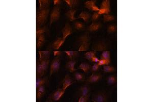 Immunofluorescence analysis of C6 cells using BRC antibody (1034) at dilution of 1:100. (BRCA1 抗体  (AA 400-699))