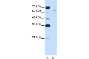 Western Blotting (WB) image for anti-Cytoplasmic Polyadenylation Element Binding Protein 2 (CPEB2) antibody (ABIN2462355) (CPEB2 抗体)