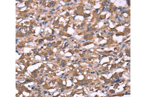 Immunohistochemistry (IHC) image for anti-Spastin (SPAST) antibody (ABIN2433051) (Spastin 抗体)
