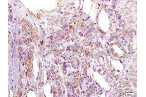 anti-Insulin-Like Growth Factor Binding Protein 2, 36kDa (IGFBP2) (AA 101-200) antibody