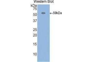 Detection of Recombinant ITIH4, Rat using Polyclonal Antibody to Inter Alpha-Globulin Inhibitor H4 (ITIH4) (ITIH4 抗体  (AA 478-722))