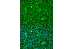 Immunofluorescence analysis of U2OS cells using CDK10 antibody. (CDK10 抗体  (AA 1-283))