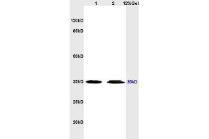 Lane 1: human colon carcinoma lysates Lane 2: human gastric carcinoma lysates probed with Anti ADORA3 Polyclonal Antibody, Unconjugated (ABIN673629) at 1:200 in 4C. (Adenosine A3 Receptor 抗体  (AA 85-180))