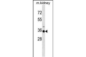 Western blot analysis in mouse kidney tissue lysates (35ug/lane). (HOXA3 抗体  (C-Term))