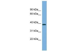 FBP2 antibody used at 1 ug/ml to detect target protein. (FBP2 抗体  (Middle Region))