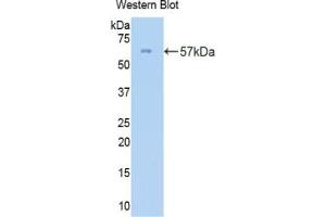 Western blot analysis of the recombinant protein. (COL3A1 抗体  (AA 1059-1466))