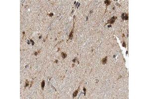 ABIN6266901 at 1/100 staining human brain tissue sections by IHC-P. (FHIT 抗体  (Internal Region))