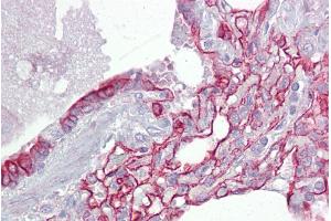Immunohistochemistry with Lung tissue at an antibody concentration of 5µg/ml using anti-PTPN11 antibody (ARP56494_P050) (PTPN11 抗体  (N-Term))