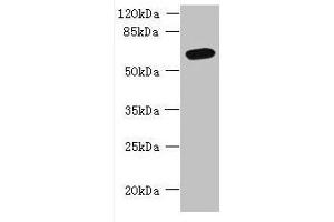 Western blot All lanes: FAM149B1 antibody at 3 μg/mL + Mouse liver tissue Secondary Goat polyclonal to rabbit IgG at 1/10000 dilution Predicted band size: 65, 59 kDa Observed band size: 65 kDa (FAM149B1 抗体  (AA 107-528))