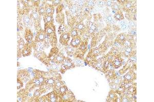 Immunohistochemistry of paraffin-embedded Mouse liver using CYP3A4 Polyclonal Antibody at dilution of 1:100 (40x lens).