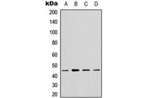 Western blot analysis of GTPBP5 expression in A549 (A), HeLa (B), NS-1 (C), PC12 (D) whole cell lysates. (GTPBP5 抗体  (Center))