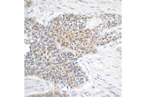 anti-Meningioma Expressed Antigen 5 (Hyaluronidase) (MGEA5) (AA 500-550) antibody