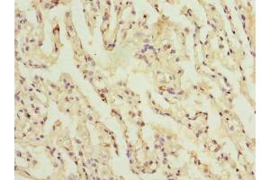 Immunohistochemistry of paraffin-embedded human lung tissue using ABIN7148104 at dilution of 1:100 (C1orf114 抗体  (AA 91-280))