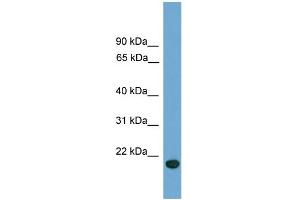 WB Suggested Anti-C9orf40 Antibody Titration: 0. (C9orf40 抗体  (Middle Region))