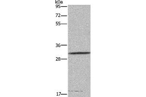 Western blot analysis of 231 cell, using ASGR1 Polyclonal Antibody at dilution of 1:300 (Asialoglycoprotein Receptor 1 抗体)