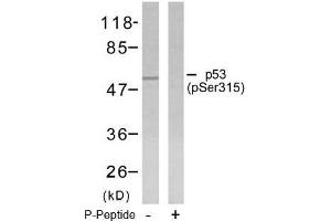 Image no. 1 for anti-Tumor Protein P53 (TP53) (pSer315) antibody (ABIN196788) (p53 抗体  (pSer315))