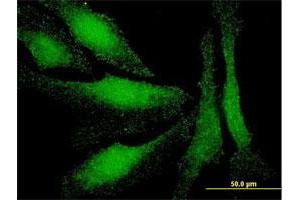 Immunofluorescence of monoclonal antibody to LMO3 on HeLa cell. (LMO3 抗体  (AA 91-146))