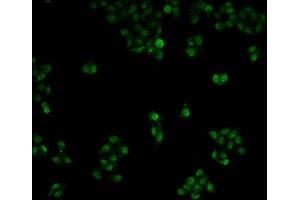 Immunofluorescence staining of Hela cells with ABIN7150422 at 1:100, counter-stained with DAPI. (POLR2A/RPB1 抗体  (AA 76-298))