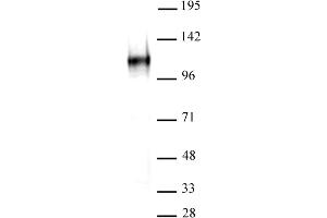 BCL11A antibody (mAb) tested by Western blot. (BCL11A 抗体  (AA 637-835))