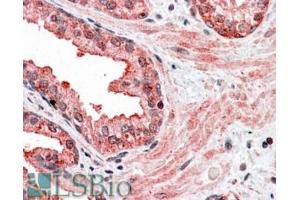 Immunohistochemistry (IHC) image for anti-Cyclin D-Type Binding-Protein 1 (CCNDBP1) (C-Term) antibody (ABIN184871)