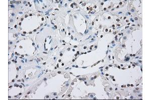 Immunohistochemical staining of paraffin-embedded Kidney tissue using anti-ILF2mouse monoclonal antibody. (ILF2 抗体)