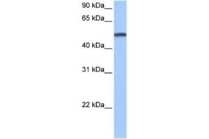 Western Blotting (WB) image for anti-Cytochrome P450, Family 1, Subfamily B, Polypeptide 1 (CYP1B1) antibody (ABIN2463468) (CYP1B1 抗体)