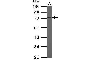 Western Blotting (WB) image for anti-Eukaryotic Translation Elongation Factor 1 delta (Guanine Nucleotide Exchange Protein) (EEF1D) antibody (ABIN2855349)