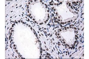 Image no. 2 for anti-Replication Protein A2, 32kDa (RPA2) antibody (ABIN1500736) (RPA2 抗体)