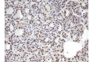 Image no. 1 for anti-Chromobox Homolog 8 (CBX8) (AA 1-260) antibody (ABIN1490659) (CBX8 抗体  (AA 1-260))