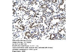 Human Lung (ZNF385A 抗体  (N-Term))
