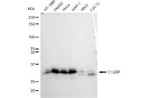 Western blotting analysis using C1QBP antibody (ABIN7798136). (Recombinant C1QBP 抗体)