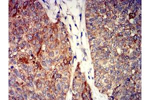 Immunohistochemistry (IHC) image for anti-Glutamate Receptor, Ionotropic, Kainate 4 (GRIK4) (AA 21-166) antibody (ABIN5611165)
