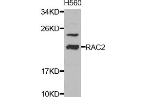 Western blot analysis of extracts of HL-60 cells, using RAC2 antibody.