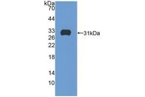 Detection of Recombinant ITGb5, Human using Polyclonal Antibody to Integrin Beta 5 (ITGb5) (Integrin beta 5 抗体  (AA 137-378))